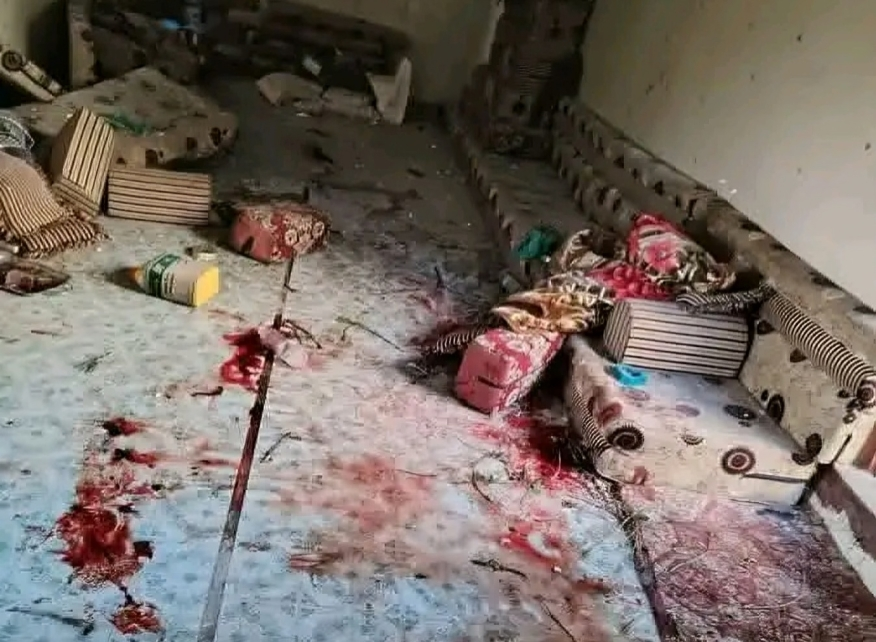 شاهد مصير مفجر مقيل في تعز 