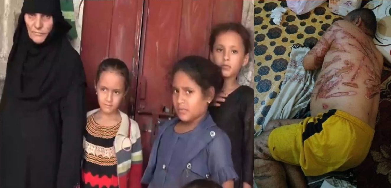 اول ظهور لاسرة ضحية تعذيب المليشيا بأبين (فيديو)