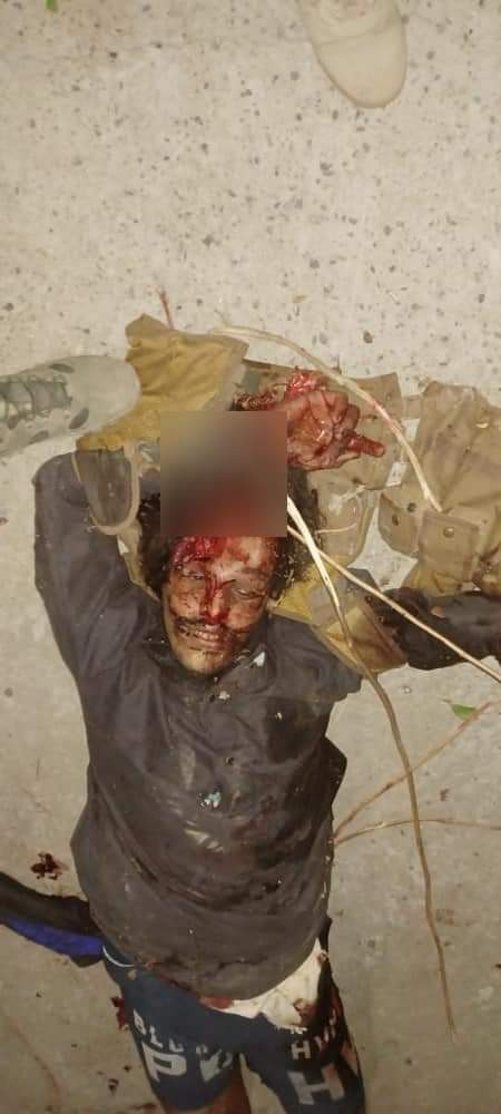 المليشيا تقع في شر غبائها وتفقد قيادات بارزة (اسماء+صور)