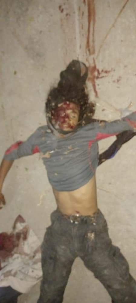 المليشيا تقع في شر غبائها وتفقد قيادات بارزة (اسماء+صور)