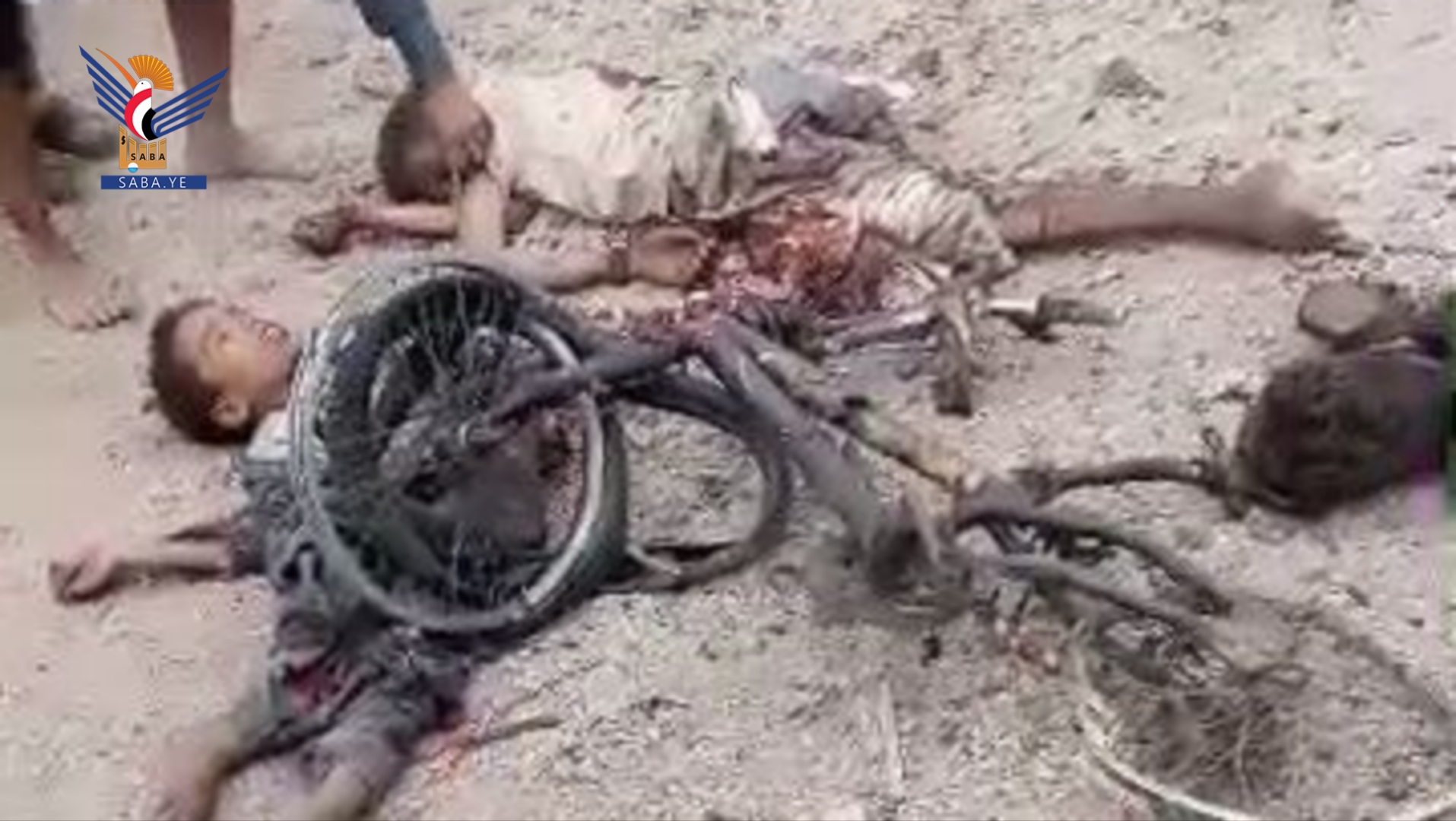 مجزرة مروعة تفجع اليمنيين (صور)