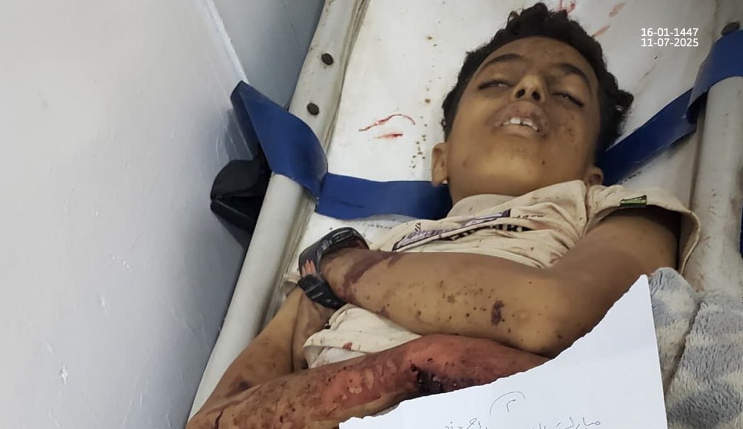 مجزرة مروعة تفجع اليمنيين (صور)