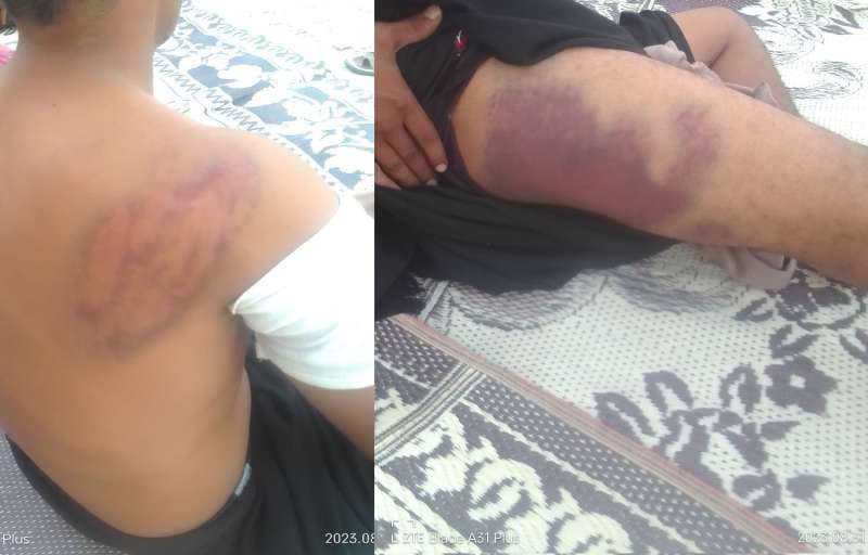 التحالف يفجر غضبا شعبيا بهذه الاهانة (صور)
