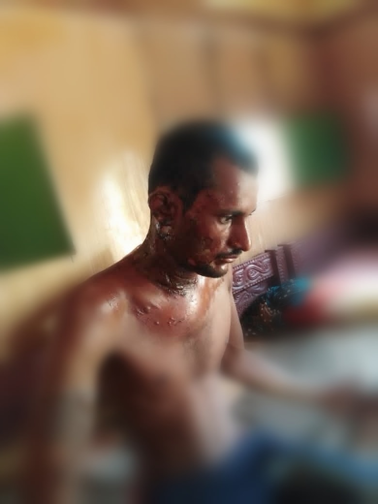 شاهد ابشع جريمة تعذيب ليمني واحراقه حيا (صور)