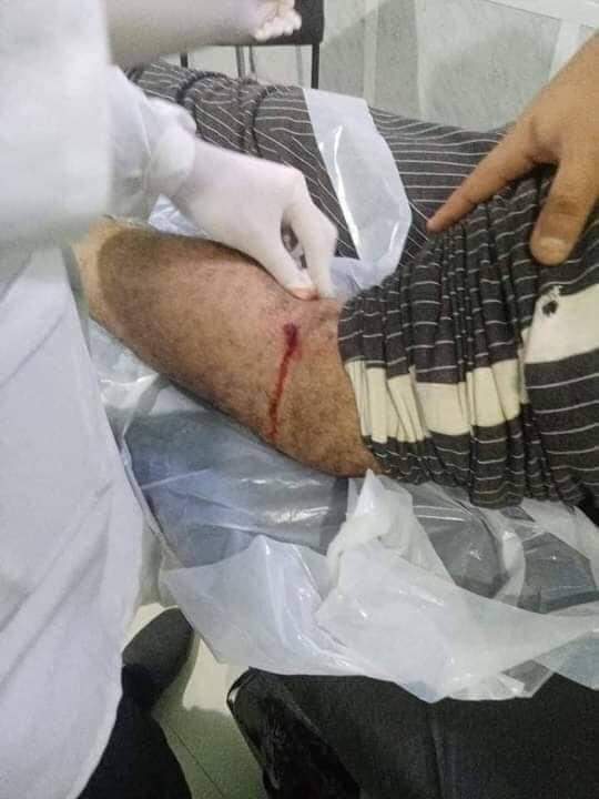 شاهد تساقط ضحايا احتفال فوز المنتخب ومحصلتهم (فيديو) 