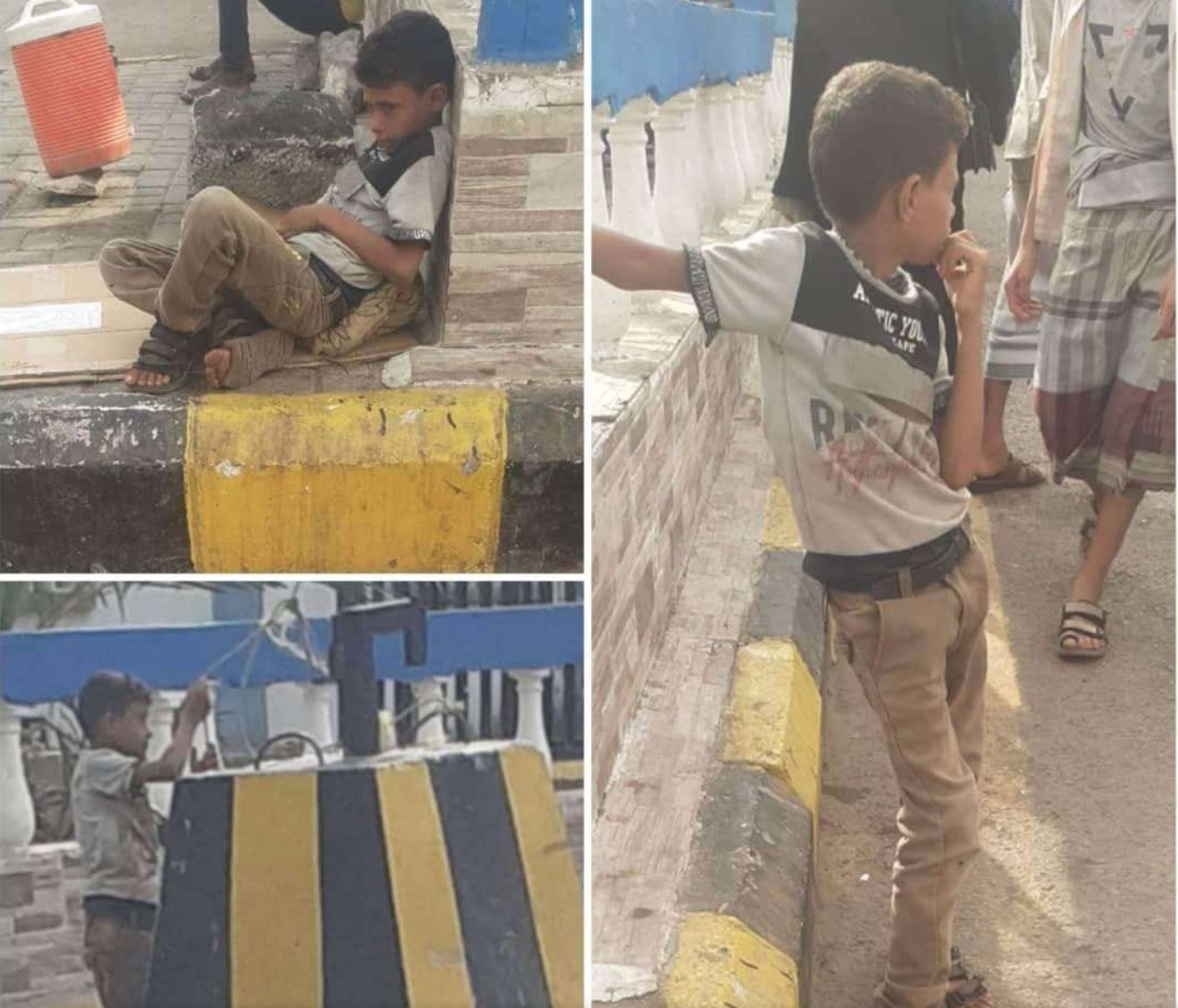 طفل مَن احرق نفسه في عدن يفجر جدلا (صور)