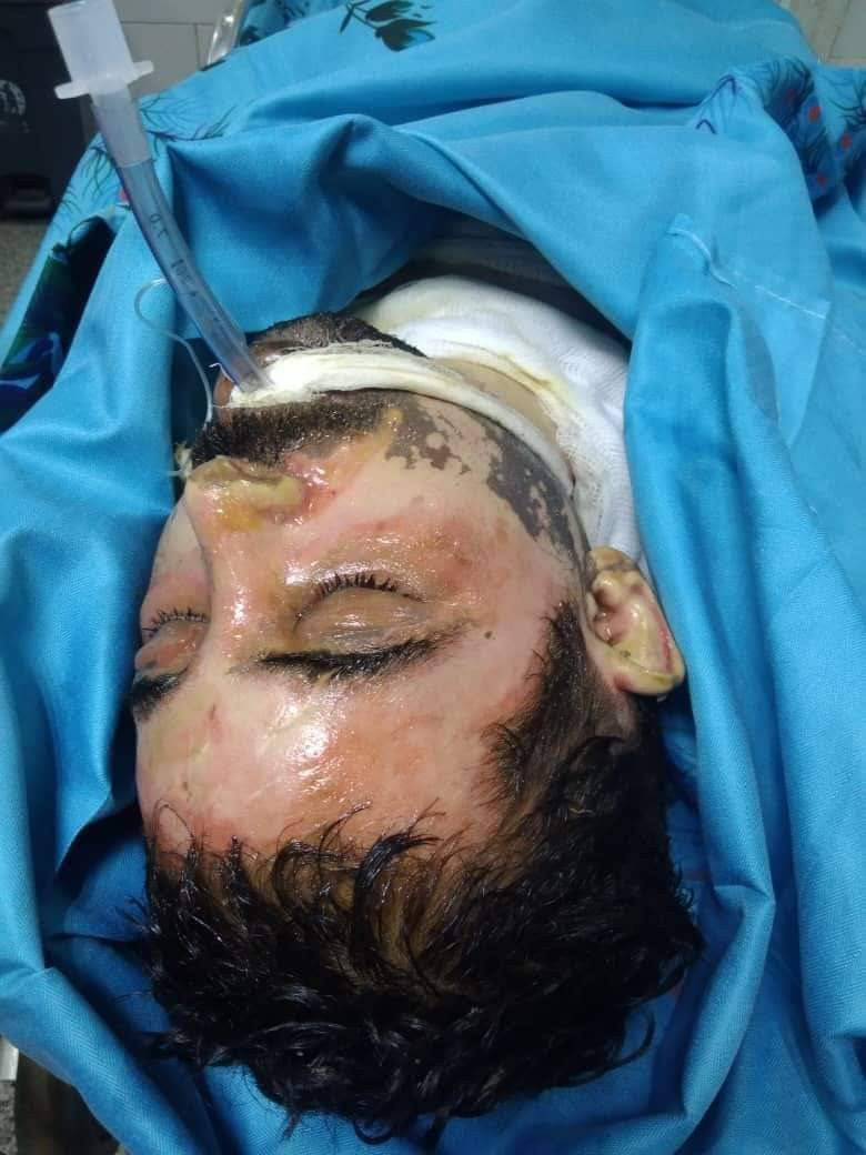 تفاصيل أليمة لنهاية مُحرق نفسه بعدن (صورة)