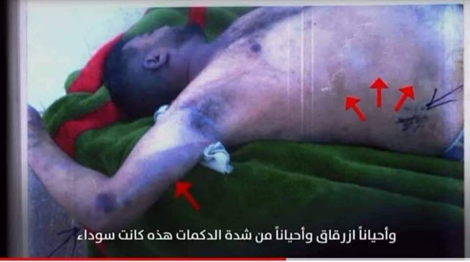 شاهد مصير جثمان السنباني بعد وصوله صنعاء (صور)