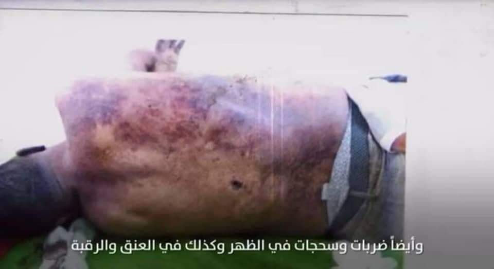 شاهد مصير جثمان السنباني بعد وصوله صنعاء (صور)