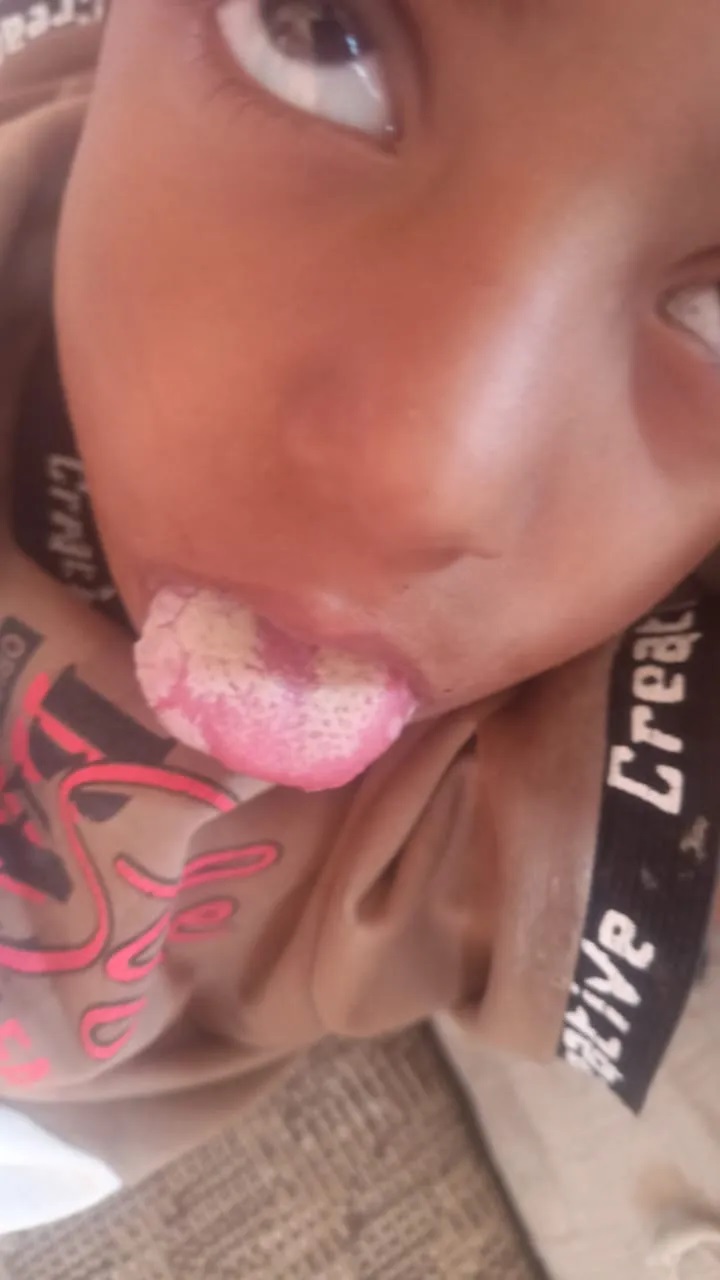 خرس اجباري يتهدد الضالع (صور)