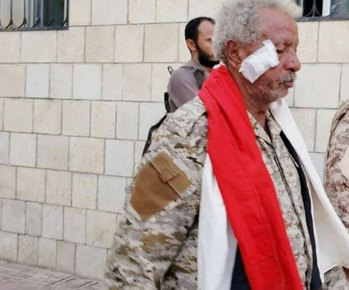 كشف حقيقة استشهاد قائد محور بيحان بمارب (صورة)